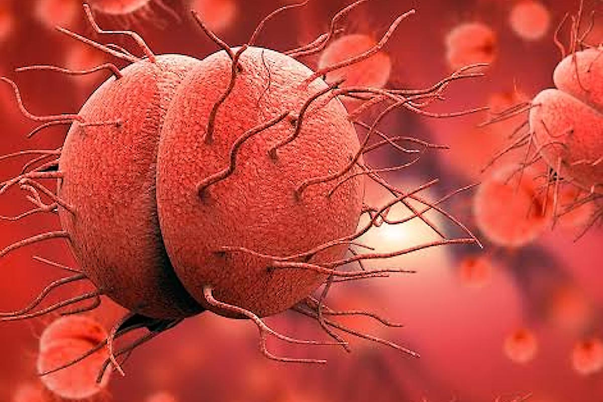 Gonorrea resistente agli antibiotici, cresce l'allarme in Europa: aumentano i casi e si riducono le cure efficaci